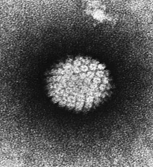 Электронная микрофотография вируса папилломы человека (ВПЧ).